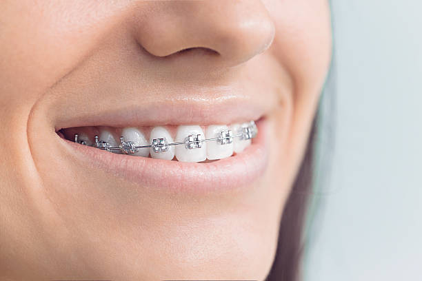 Best Tooth Extraction  in Minster, OH